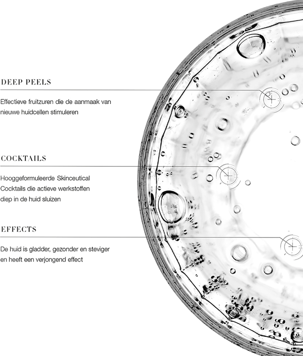 cenzaa salonbehandeling personal peel program